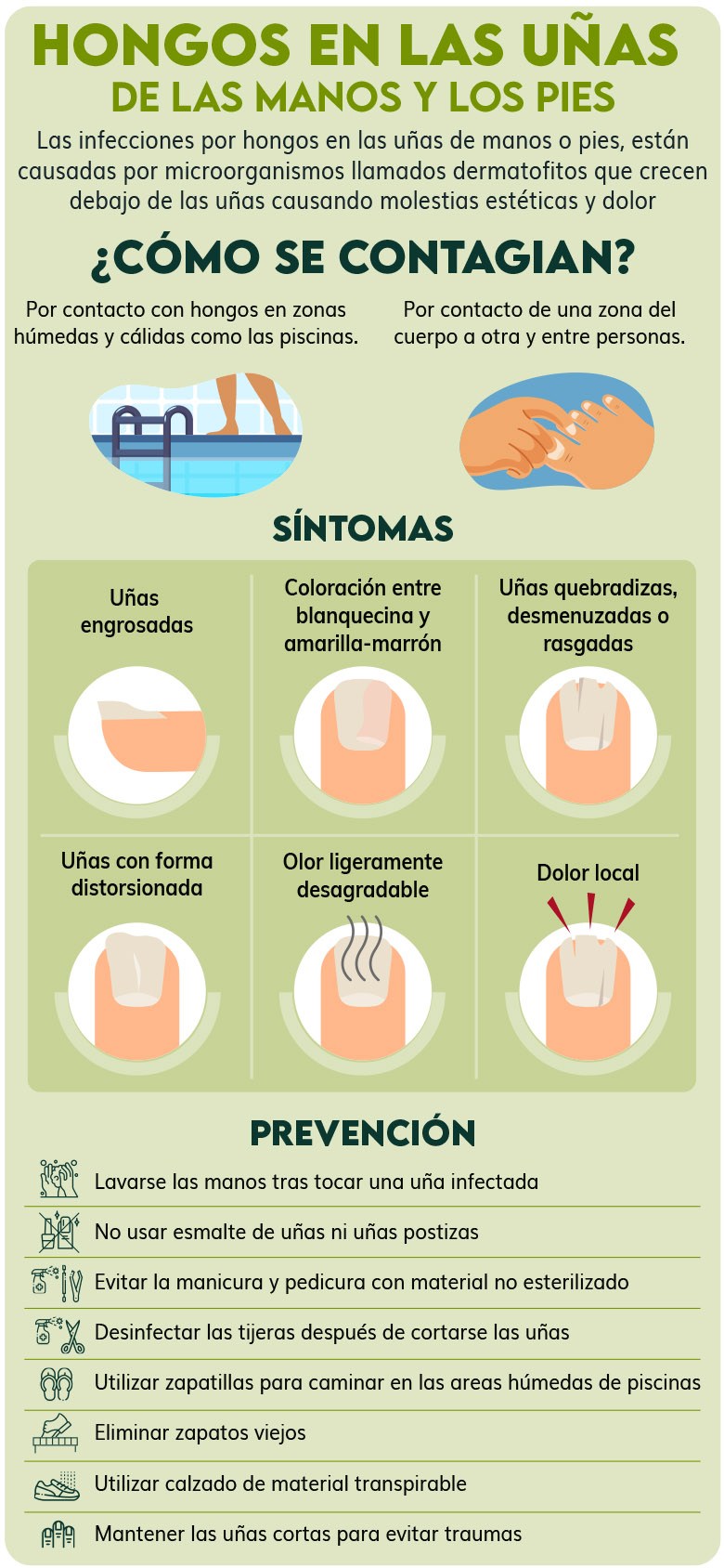 Cómo prevenir y tratar la aparición de hongos en las uñas