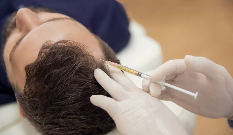 cómo evitar la caída del pelo tratamiento