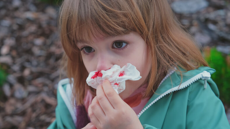 Sangrado nasal