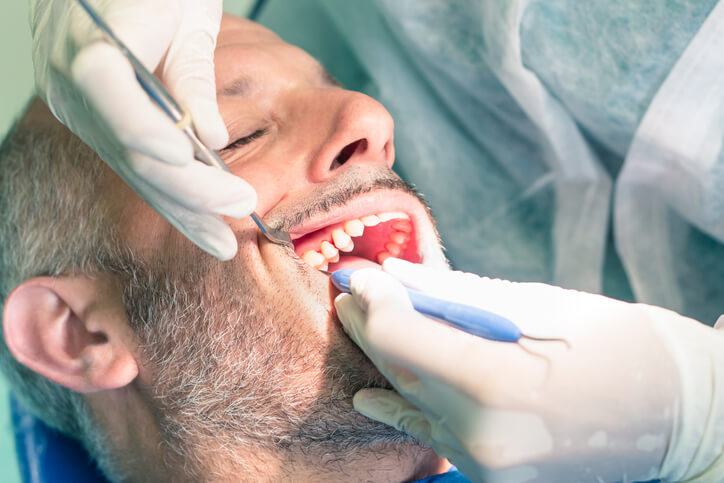 Sarro dental