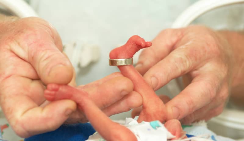 bebé prematuro, muy poco peso y tamaño