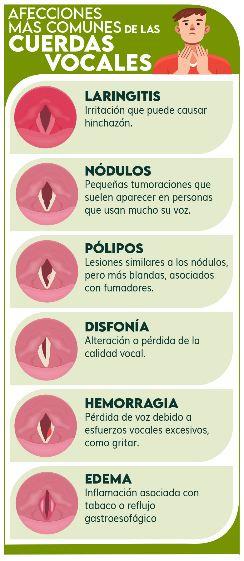 Infografía - qué son las cuerdas vocales