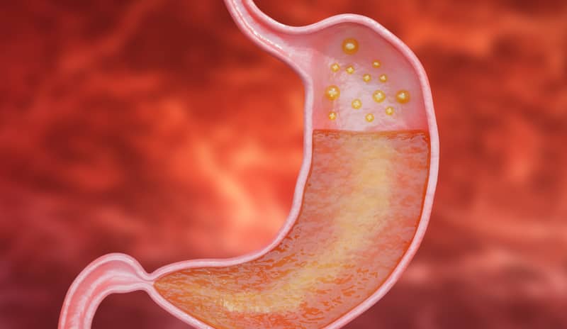 La bacteria Helicobacter pylori es una de las causas más comunes de gastritis crónica.