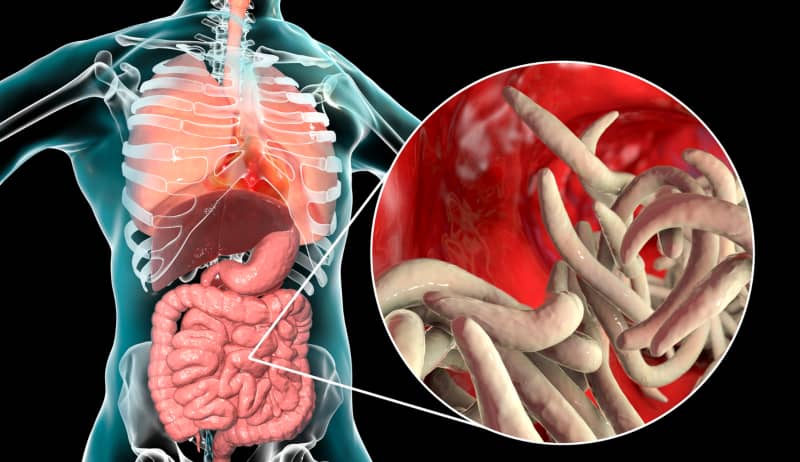 Existen varios tipos de lombrices intestinales que pueden afectar a los seres humanos.