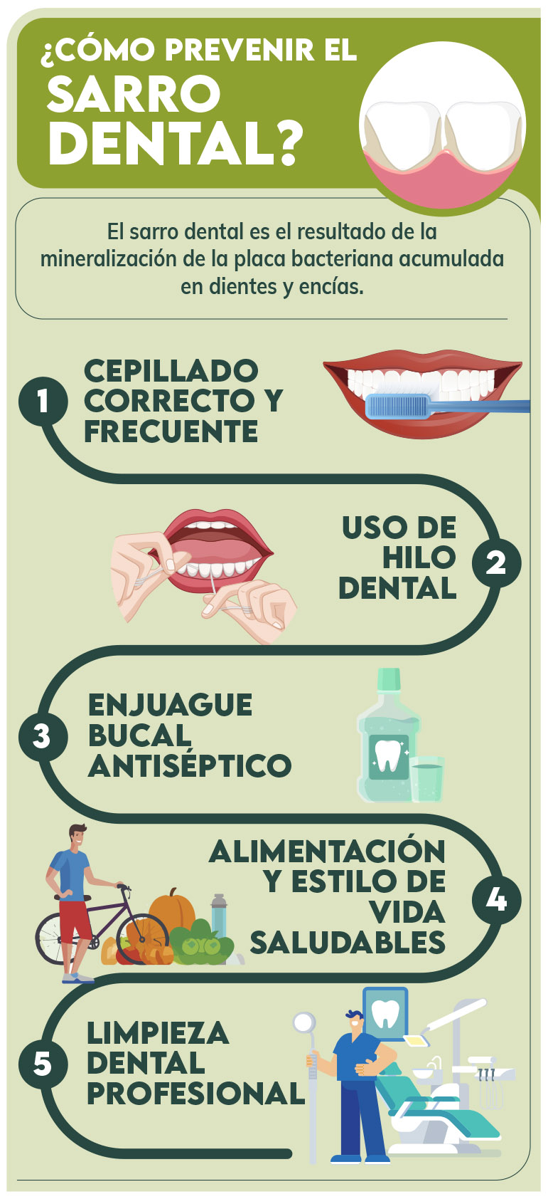 Infografía - Sarro dental