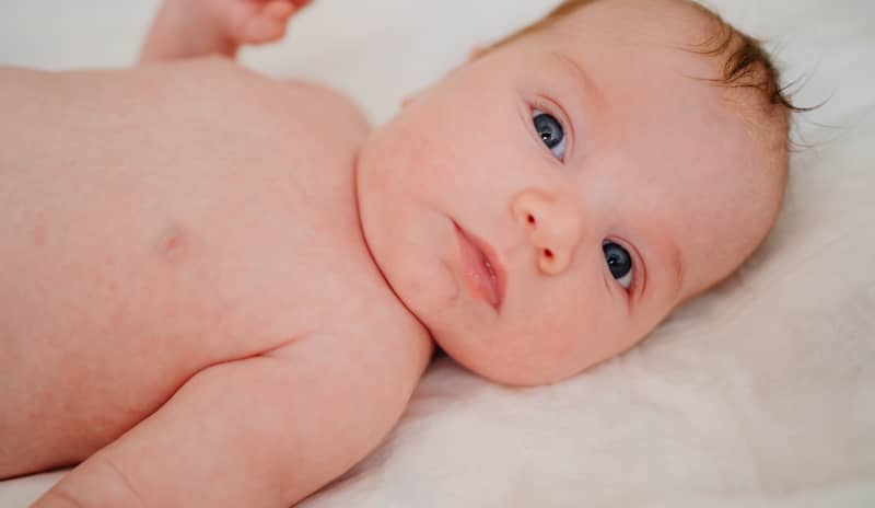 Las escamas de la dermatitis seborreica infantil pueden ser blancas o amarillas