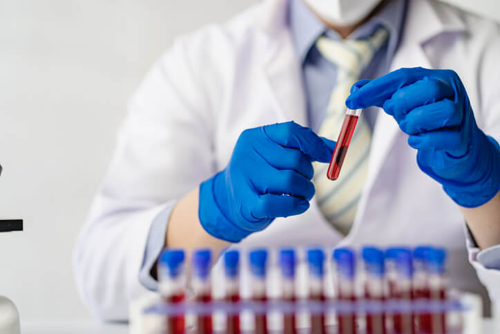 Para asegurarse de su fiabilidad, las muestras deben etiquetarse correctamente para su traslado al laboratorio. Solo de esta forma se podrán interpretar los análisis de sangre de forma correcta y acorde al paciente.