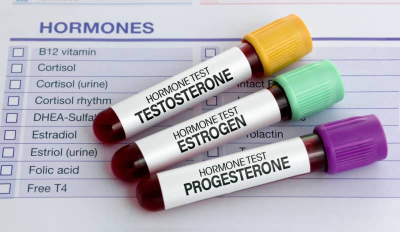 Test hormonal antes de comenzar la terapia hormonal sustitutiva