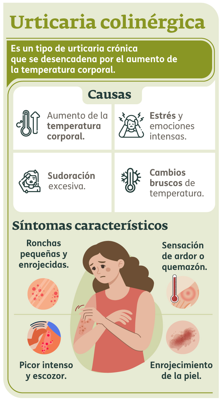 Infografía - Urticaria colinérgica