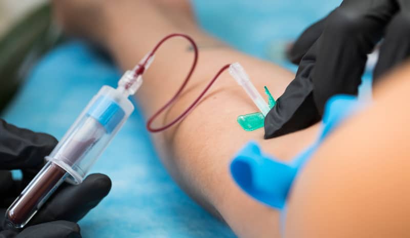 Brazo de una persona y jeringuilla mientras se realiza una extracción de sangre para un análisis clínico, procedimiento habitual para medir los niveles de colesterol bueno y malo en el organismo.