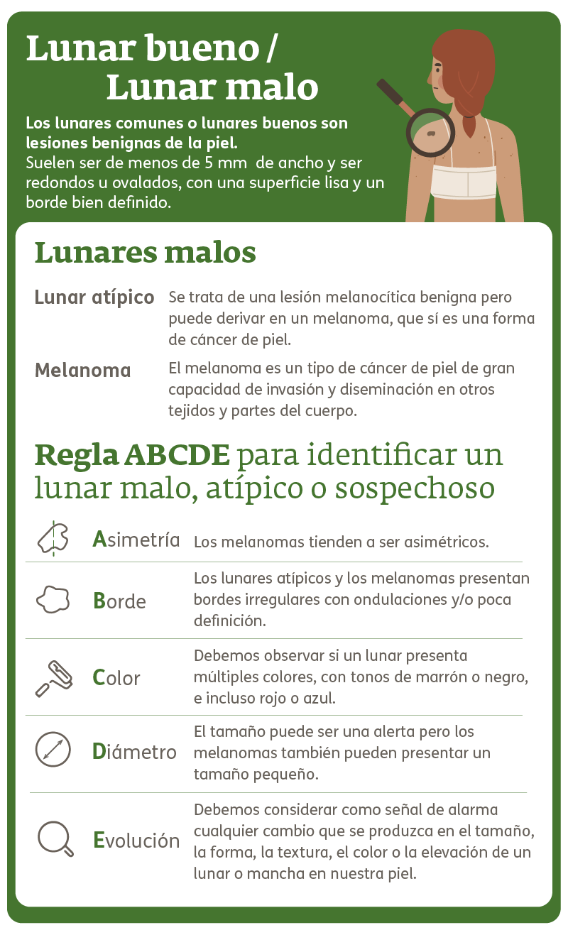 Infografia - Lunares malignos