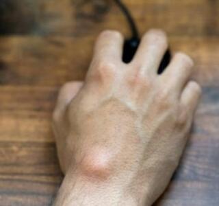 bultos de grasa o lipomas