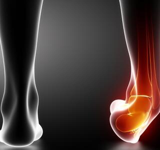 lesiones que afectan los ligamentos