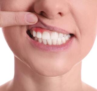 Chica con un absceso dental