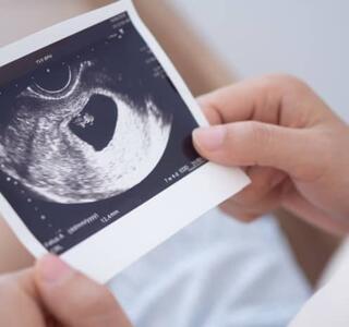 ecografía del embarazo anembrionario