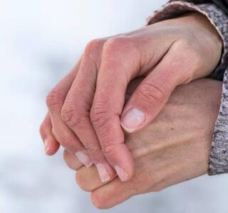 sabañones en las manos