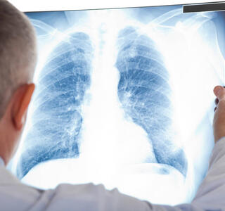 mitos sobre el cáncer de pulmon