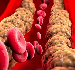 El colesterol bueno y malo es un tema que genera muchas dudas