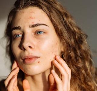 Mujer tocando suavemente su rostro frente al espejo, observando su piel para identificar los diferentes tipos de granos en la cara y sus características.