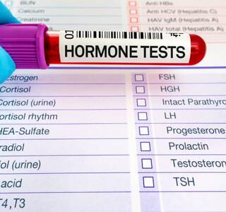 Tubo de muestra de sangre etiquetado como ‘Hormone Tests’ sostenido por una mano con guante médico, sobre un formulario de análisis endocrinos, ilustrando el diagnóstico de un desequilibrio hormonal