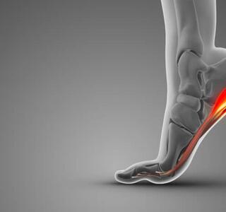 Ilustración médica de un pie elevándose con la zona del talón y la fascia marcada en rojo para mostrar el dolor característico de la fascitis plantar.