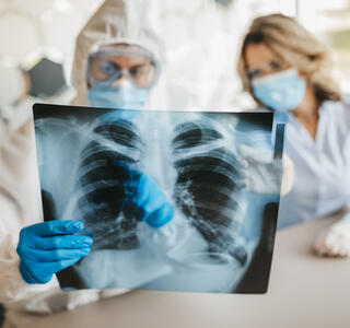 secuelas pulmonares de la covid