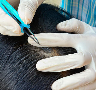 por qué salen las canas