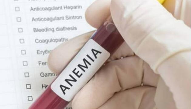 Mitos sobre la anemia