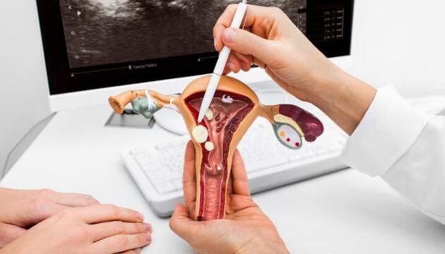 polipos en el utero