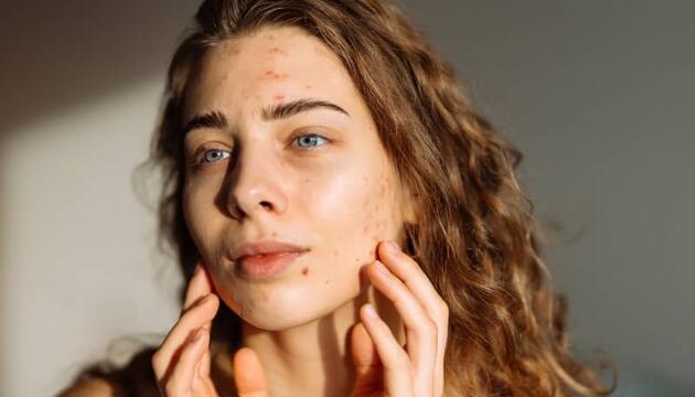 Mujer tocando suavemente su rostro frente al espejo, observando su piel para identificar los diferentes tipos de granos en la cara y sus características.