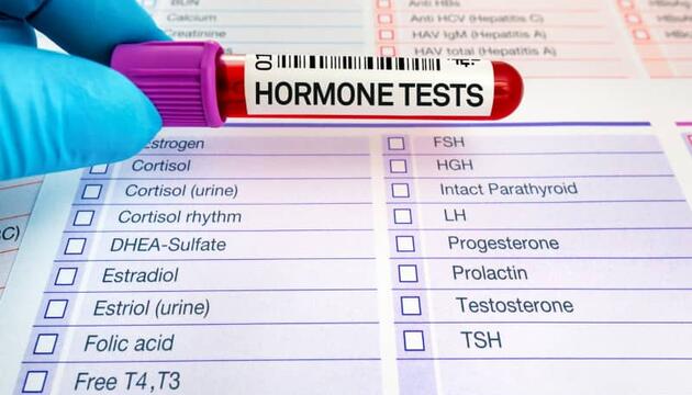 Tubo de muestra de sangre etiquetado como ‘Hormone Tests’ sostenido por una mano con guante médico, sobre un formulario de análisis endocrinos, ilustrando el diagnóstico de un desequilibrio hormonal