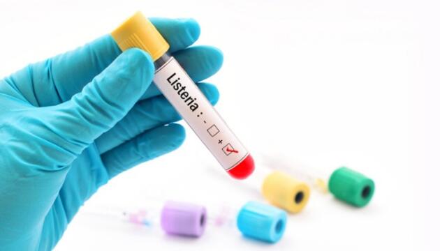 Listeria. Consejos para evitarla Cómo evitar la listeria