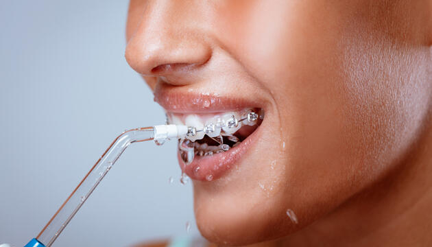 Irrigador dental Irrigador dental