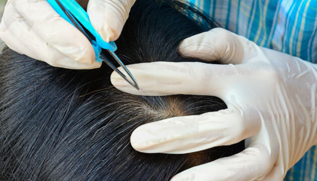 canas en el cabello