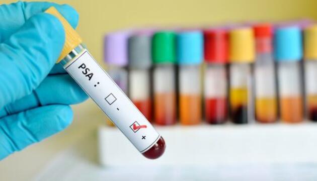 inmunologia cancer inmunologia cancer