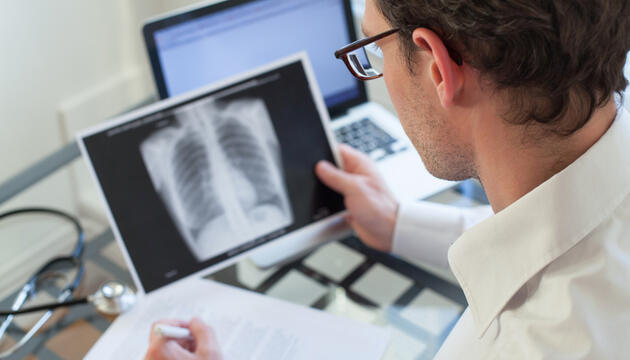 Enfermedad Pulmonar Obstructiva Crónica (EPOC) EPOC