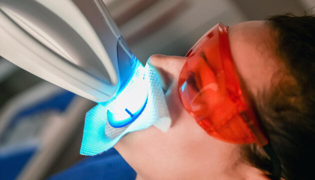 Blanqueador dental blanqueador dental