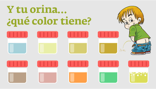 Color de la orina: ¿Qué dice de tu salud? Color de la orina: ¿Qué dice de tu salud?