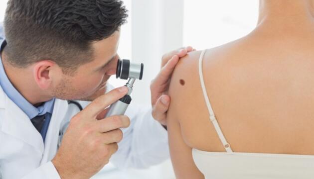 Melanoma, ¿qué es y cómo prevenirlo? Melanoma, ¿qué es y cómo prevenirlo?