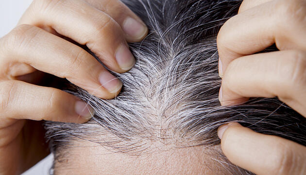Relación entre canas y calvicie Canas y calvicie