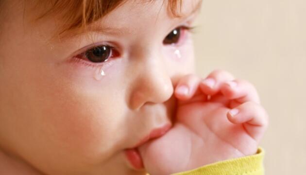 Conjuntivitis infantil no infecciosa conjuntivitis infantil no infecciosa