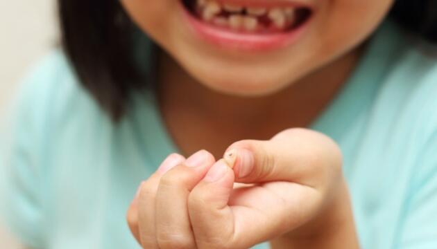Lesiones dentales Lesiones dentales