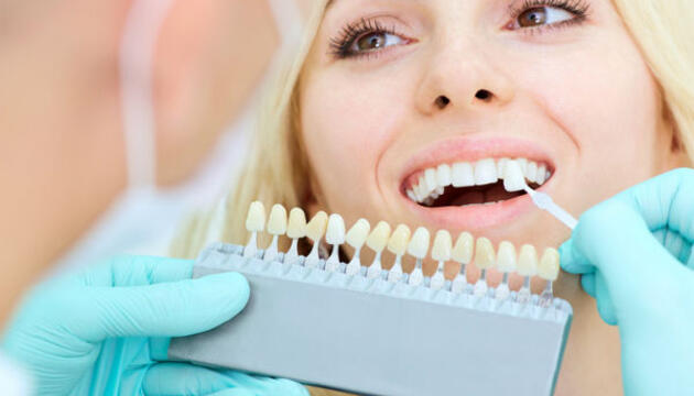 Implantes dentales Implantes dentales