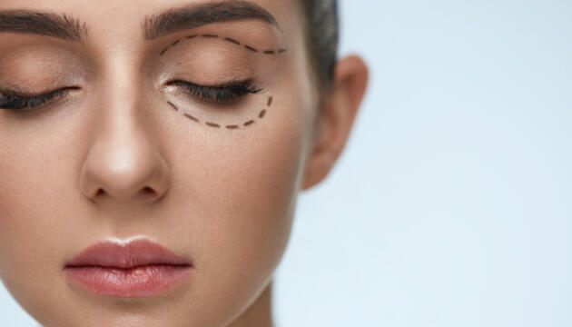 Blefaroplastia para corregir las bolsas de los párpados Blefaroplastia para corregir las bolsas de los párpados