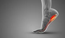 Ilustración médica de un pie elevándose con la zona del talón y la fascia marcada en rojo para mostrar el dolor característico de la fascitis plantar.