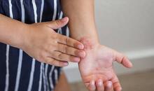 Persona frotándose el antebrazo con la mano por irritación y picor y mostrando un eccema , síntoma típico de dermatitis atópica.