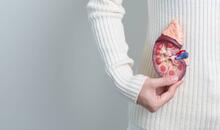 Persona sosteniendo un modelo anatómico de un riñón sobre el abdomen, ilustrando los cálculos renales