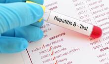 Guante médico sostiene un tubo de sangre con etiqueta “Hepatitis B - Test” sobre un informe de laboratorio con resultados de hepatitis B